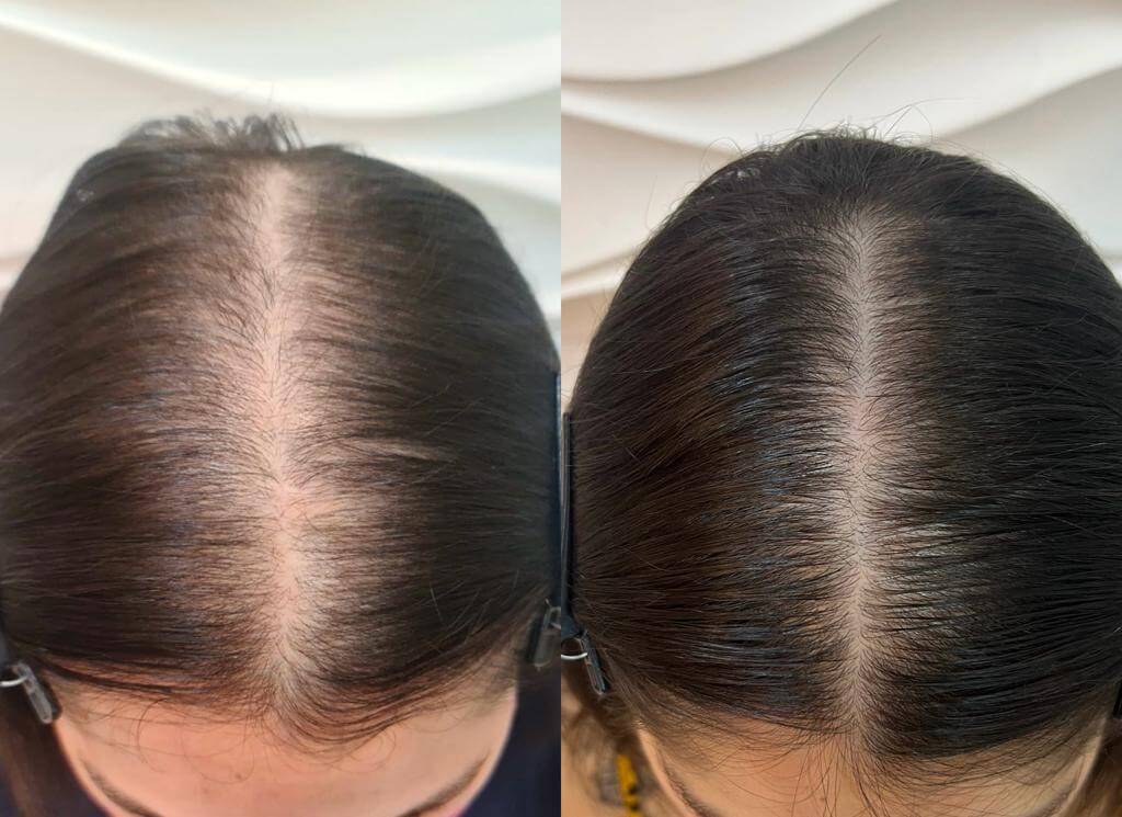 24d4887b-37c6-420b-98f6-10b8b46bab39