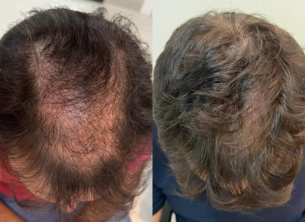 56ac013e-5ccb-4879-8ea7-102ff46e85cc