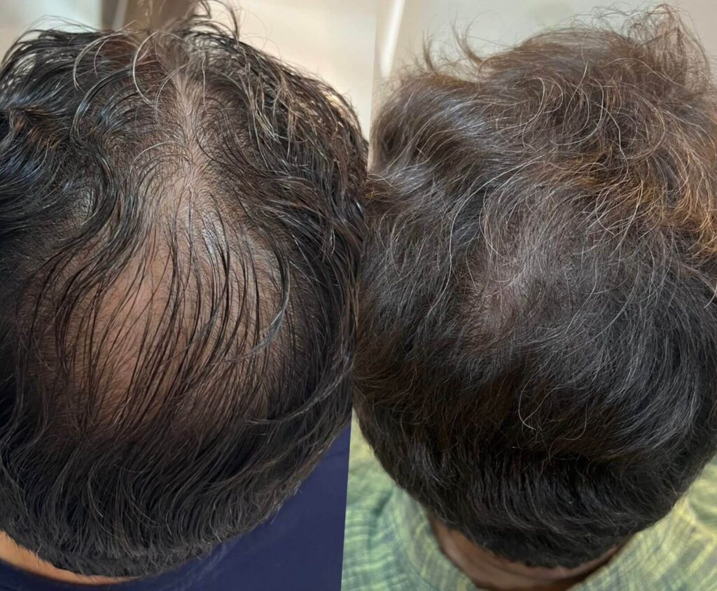 bd860044-5afb-44ec-b2c4-4a55729efb66